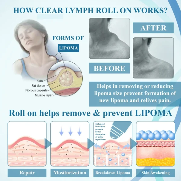 ATTDX™ LumpsClear Lymph Support Roll-On