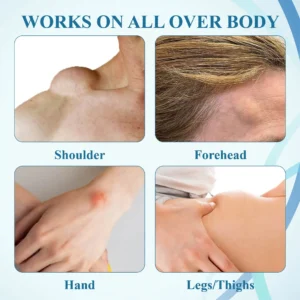 ATTDX™ LumpsClear Lymph Support Roll-On