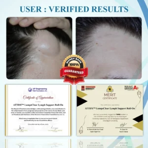 ATTDX™ LumpsClear Lymph Support Roll-On