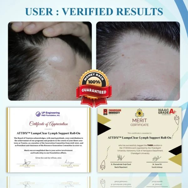 ATTDX™ LumpsClear Lymph Support Roll-On