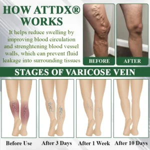 ATTDX® MicroDrain Edema Relief Microneedle Patch