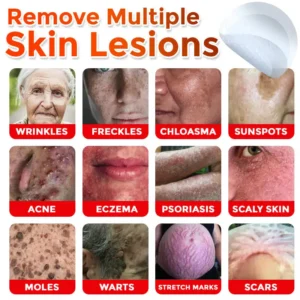 ATTDX® MicroNeedle Botanic Skin Tag Removal Patch