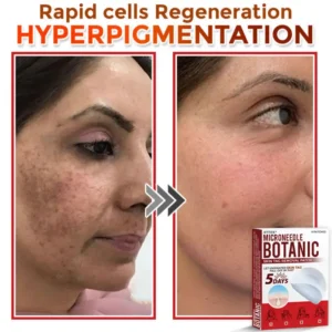 ATTDX® MicroNeedle Botanic Skin Tag Removal Patch