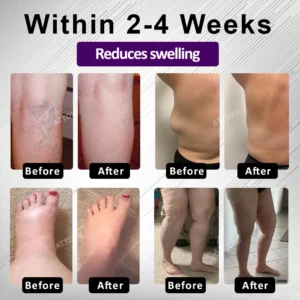 ATTDX® Night-Time Edema Relief Sleep Cream