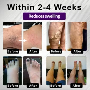 ATTDX® Night-Time Edema Relief Sleep Cream