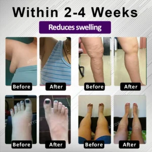 ATTDX® NightDrain Leg Therapy Edema Cream