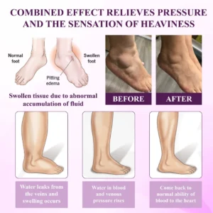 ATTDX® NightDrain Leg Therapy Edema Cream