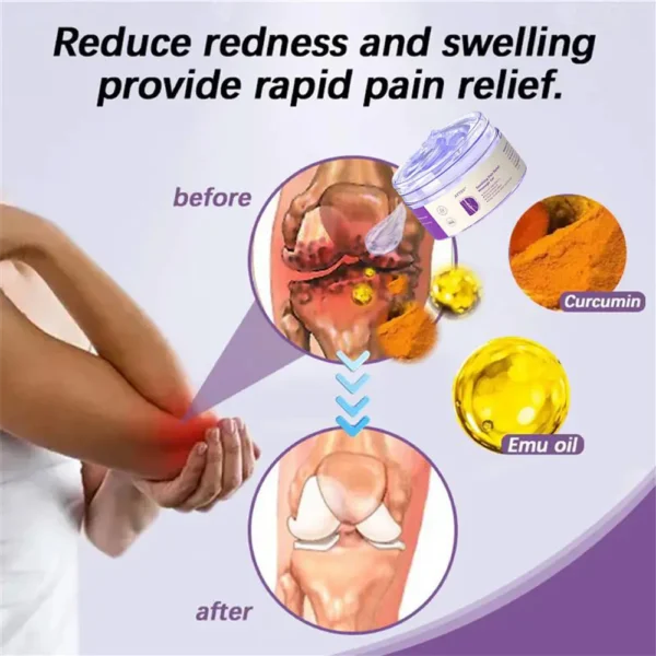 ATTDX® Turmeric Emu Oil Arthritis Soothing Pain Relief Gel