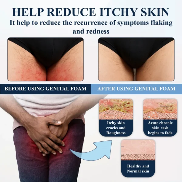 ATTDX® Advanced HPV & Rash Relief Genital Foam