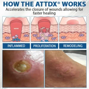 ATTDX® Diabetes Foot Guard Fast Recovery Spray