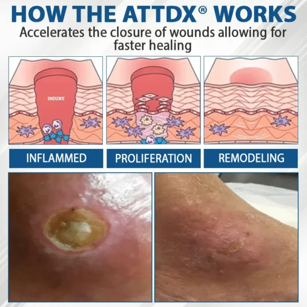 ATTDX® Diabetes Foot Guard Fast Recovery Spray