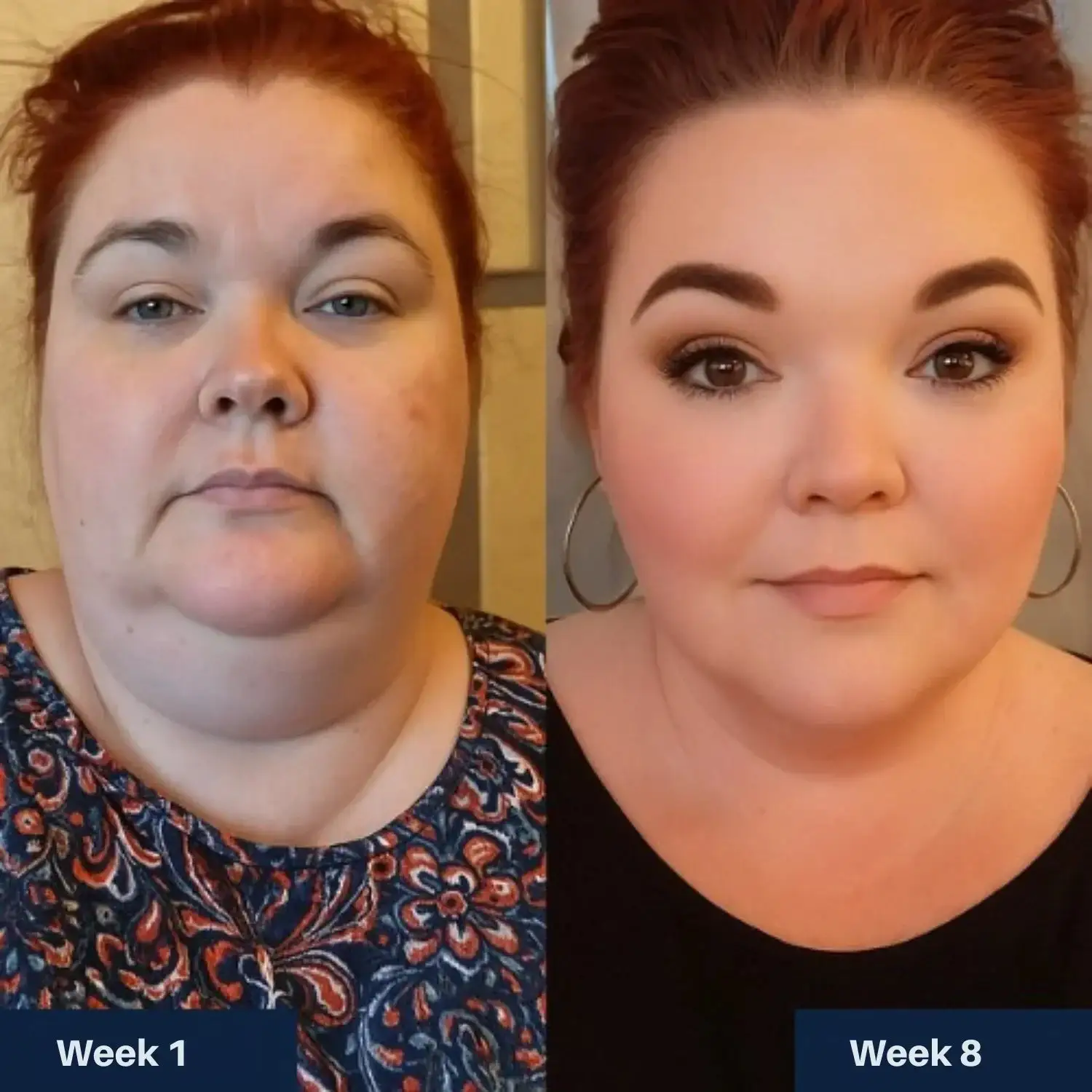 ATTDX® GLP-1 Weight Management Patches Pro