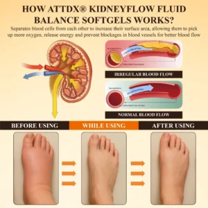 ATTDX® KidneyFlow Fluid Balance Softgels