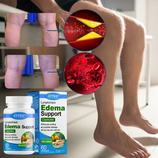 ATTDX® LymphoHerb Edema Support Capsules