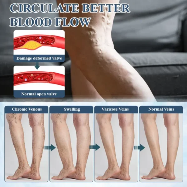 ATTDX® LymphoHerb Edema Support Capsules