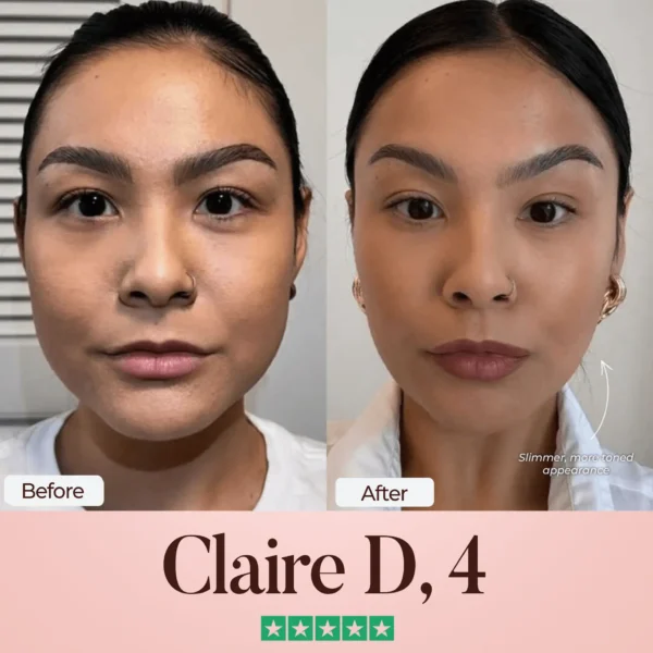 ATTDX® SculptFix Mask Infused with Retinol & Collagen 👩 Reveal Your Best Jawline