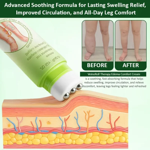 ATTDX® VeinoRoll Therapy Edema Comfort Cream