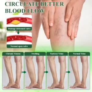 ATTDX® VeinoRoll Therapy Edema Comfort Cream