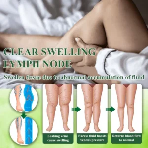 ATTDX® VeinoRoll Therapy Edema Comfort Cream