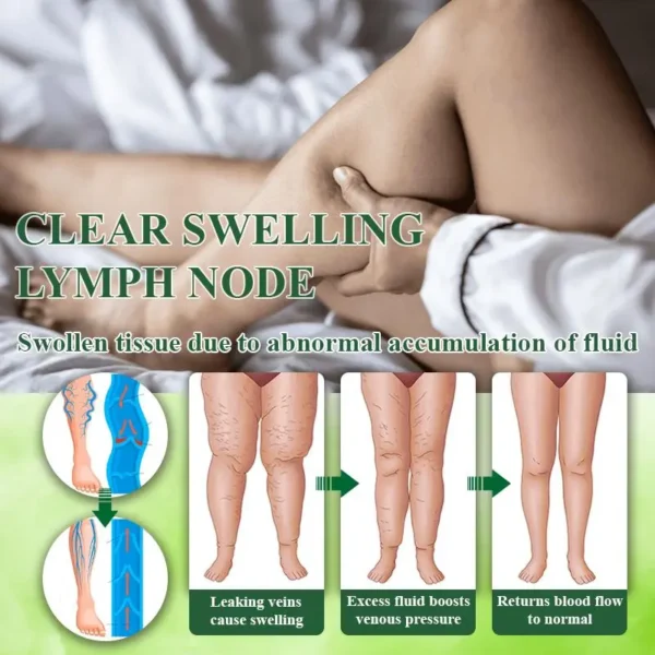 ATTDX® VeinoRoll Therapy Edema Comfort Cream