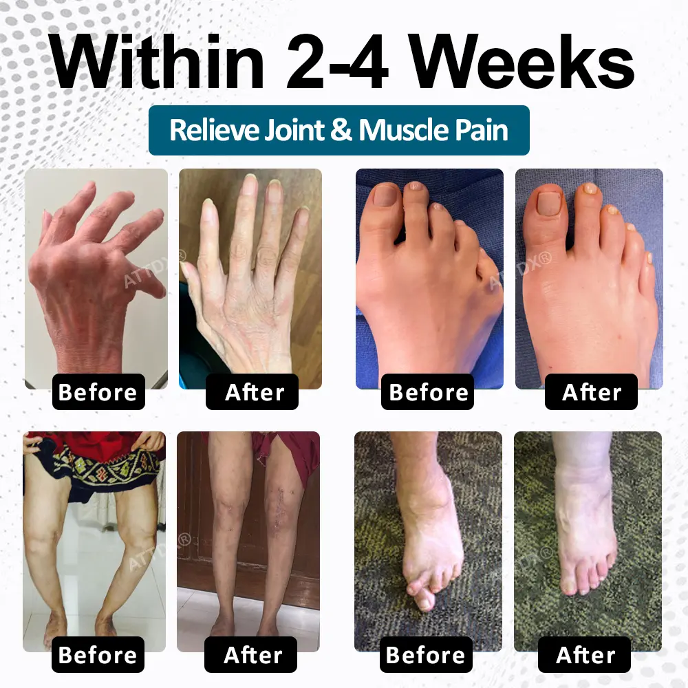 ATTDX® BPC-157 ArthroFlex Motion+ Capsules