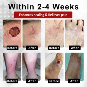 ATTDX® DiabeHeal Magnesium Recovery Capsules