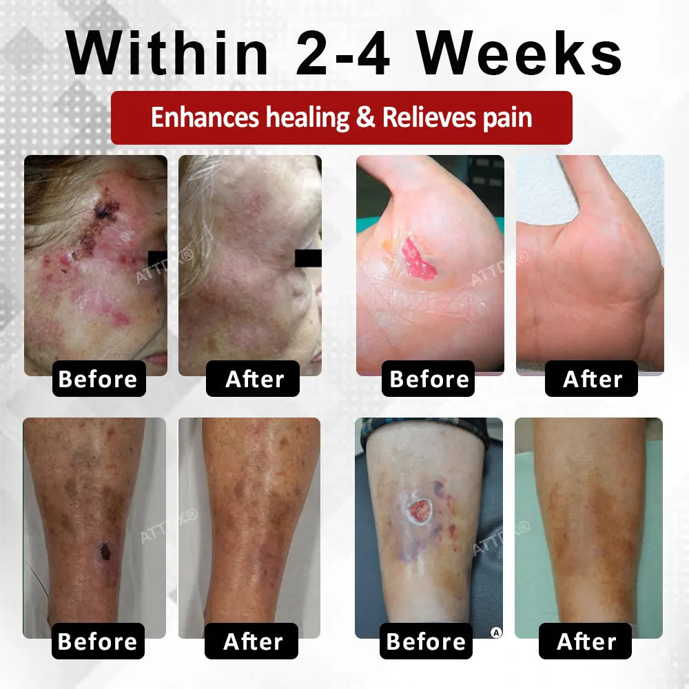 ATTDX® DiabeHeal Magnesium Recovery Capsules