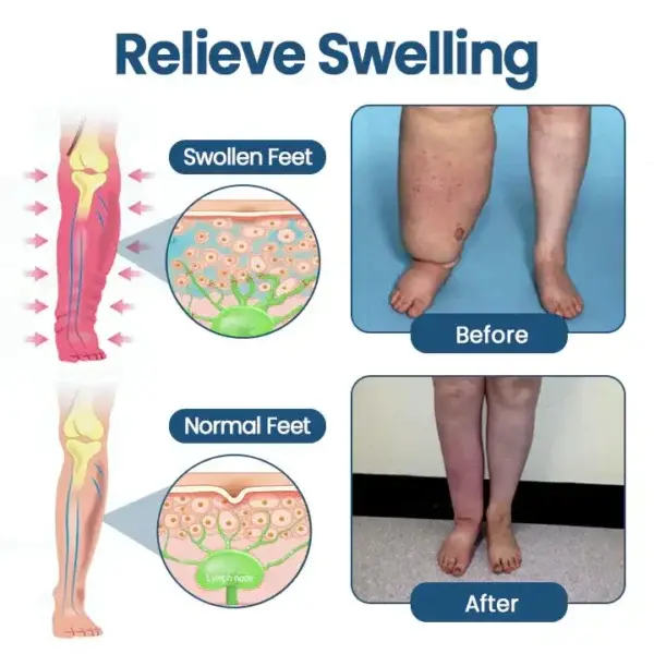 ATTDX® Roll-On Pump Cream