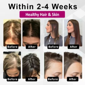 ATTDX® ThickHer Hair VitaGrowth Capsules