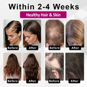 ATTDX® ThickHer Hair VitaGrowth Capsules