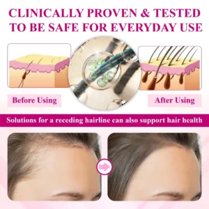 ATTDX® ThickHer Hair VitaGrowth Capsules