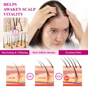 ATTDX® ThickHer Hair VitaGrowth Capsules