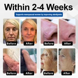 ATTDX® CollaRenew Complex Inner Rebuild Capsules