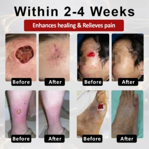 ATTDX® GlucoseGuard Skin Rescue Cream