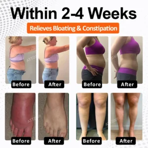 ATTDX® GutLight TripleMag Bloating Relief Capsules