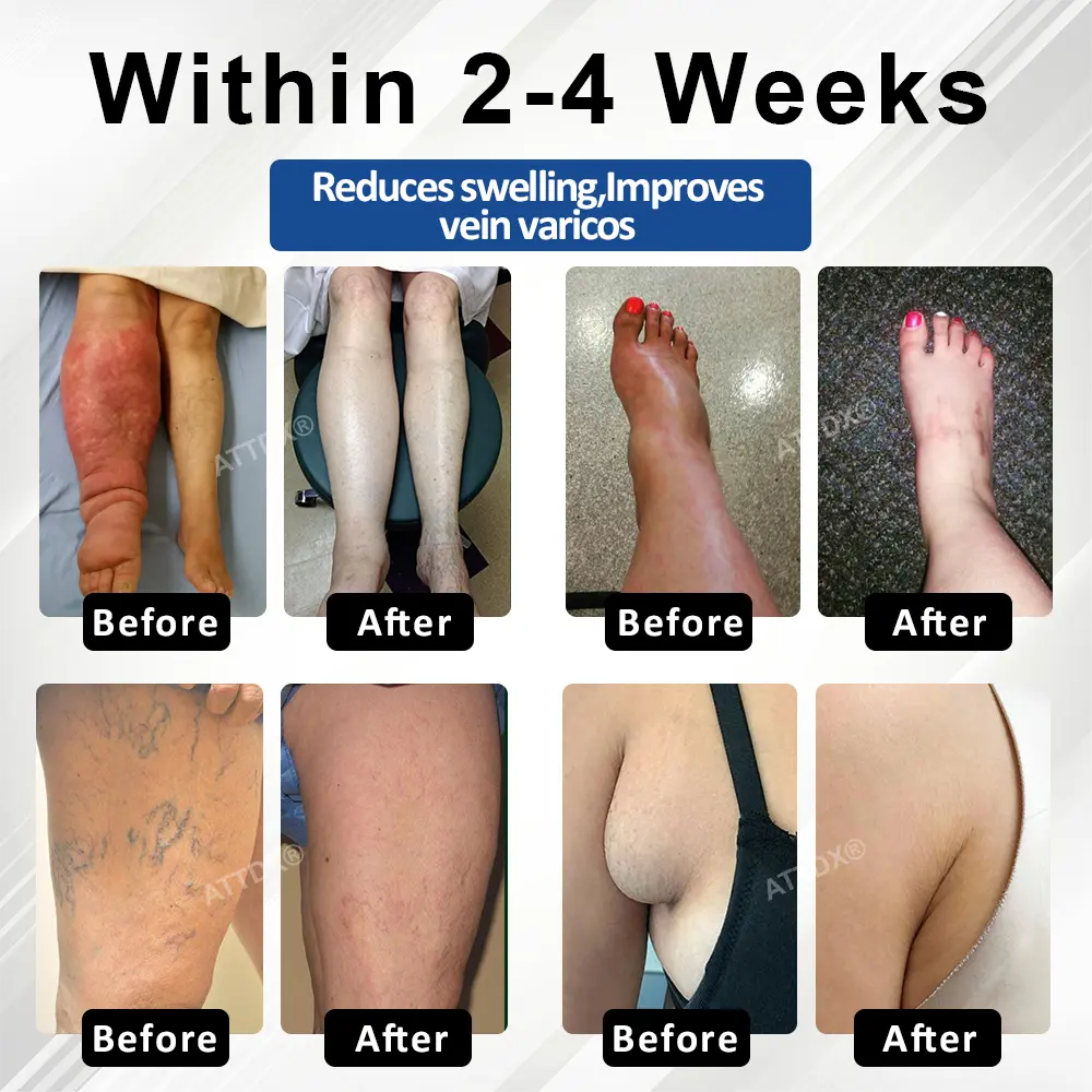 ATTDX® HeptaMag 7-Form Edema Formula Capsules