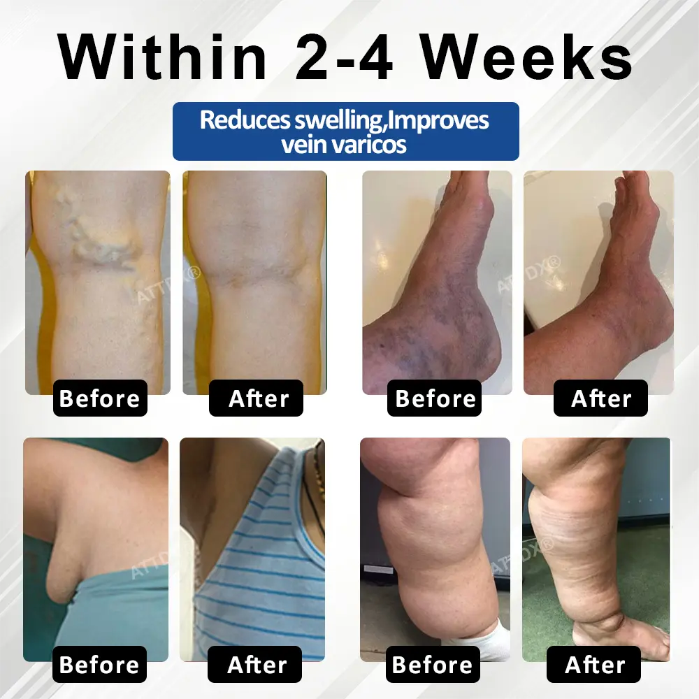 ATTDX® HeptaMag 7-Form Edema Formula Capsules