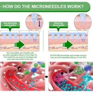 𝐀𝐮𝐬𝐬𝐢𝐞 𝐃𝐨𝐜𝐭𝐨𝐫 𝐑𝐞𝐜𝐨𝐦𝐦𝐞𝐧𝐝𝐞𝐝 👨‍⚕️ | 𝑴𝑼𝑹𝑾𝑶𝑵® Moringa & Berberine 10-IN-1 Advanced Nano Microneedle Patch
