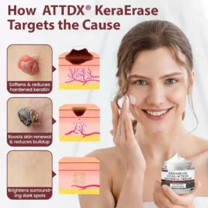 ATTDX® KeraErase Dual-Action Renewal Cream