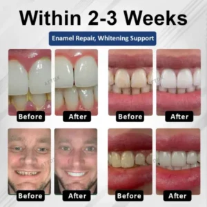 ATTDX® BioEnamel Biomimetic Tooth Armor Drops