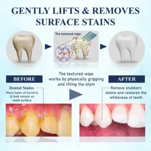 ATTDX® BrighteWipe Teeth Cleaning Finger Wipes