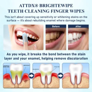 ATTDX® BrighteWipe Teeth Cleaning Finger Wipes